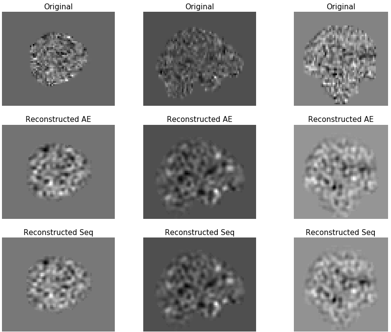 fMRI autism project visualization